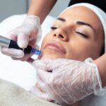 MICRONEEDLING TRAINING COURSE