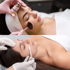 DERMAPLANING CHEMICAL PEEL TRAINING COURSE - CIA Nails & Beauty Academy in London